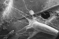 Lyonetia 1
